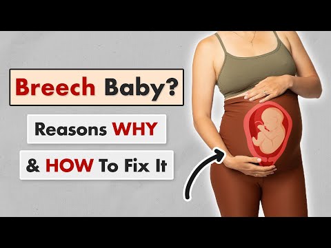 Get Baby Head Down: Exercises to Do for Breech!