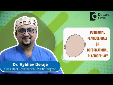 Flat Head Syndrome| Plagiocephaly & Its Treatment #newborn  - Dr. Vybhav Deraje | Doctors' Circle