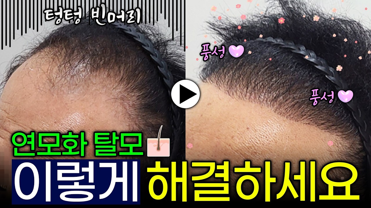 더원츠의원 유튜브