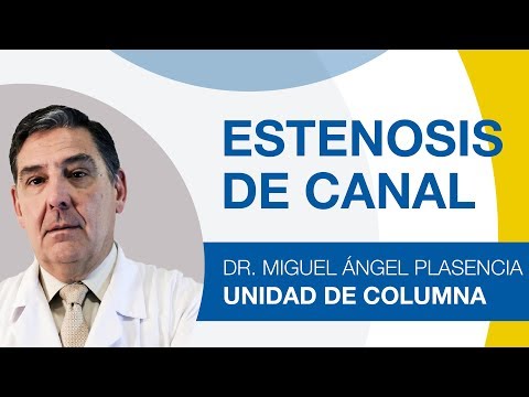 Estenosis de canal