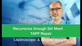 Miniaturka - Recurrence through slit mesh. Repair TAPP. Metin Ertem MD.FACS
