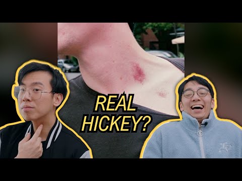 Can You Tell The Difference Between a Hickey or Violin Hickey?