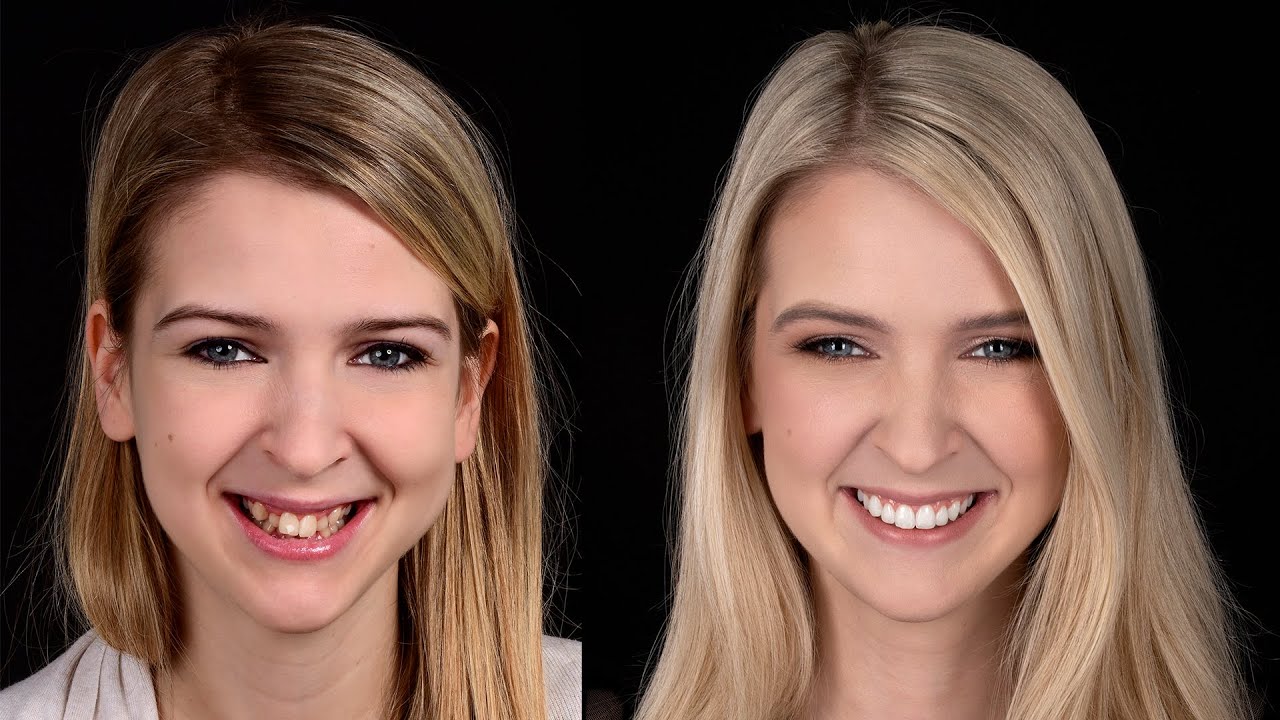 Metamorfoza uśmiechu Eweliny