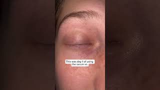 I ripped out all my eyelashes… #eyelashes