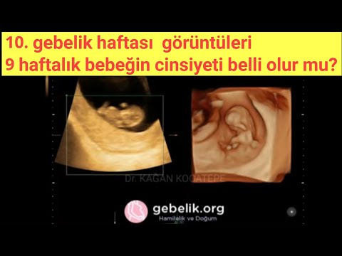 9 haftalık gebelik. 10. gebelik haftasında bebek ultrasonda nasıl gözükür, cinsiyet anlaşılır mı?