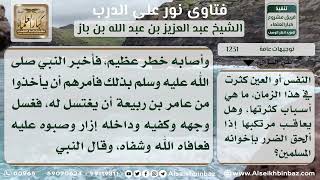 صورة 1231 - أسباب وقوع العين وحكم مرتكبها - نور على الدرب