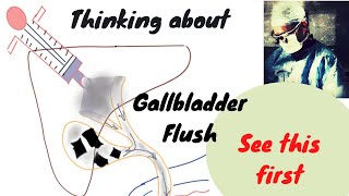 Thinking about Gallbladder Flush See this first