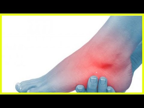 Warum Rückenschmerzen während des Schlafes Komplexe physikalische Therapie mit zervikaler Osteochondrose Video
