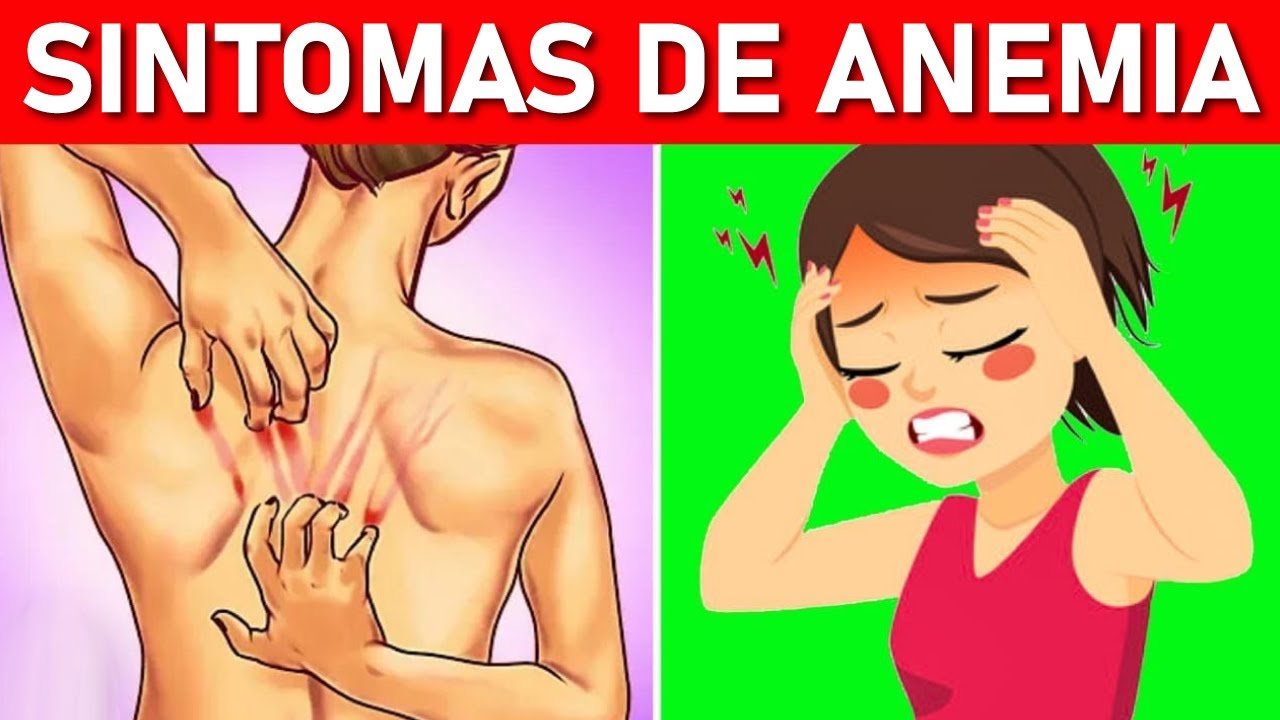 10 Sintomas Silenciosos de ANEMIA que Você não Deve Ignorar