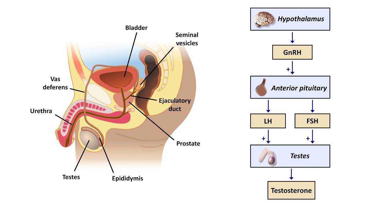 An Approach to Male Infertility