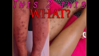 Scarred legs? Fear no more! {tutorial}