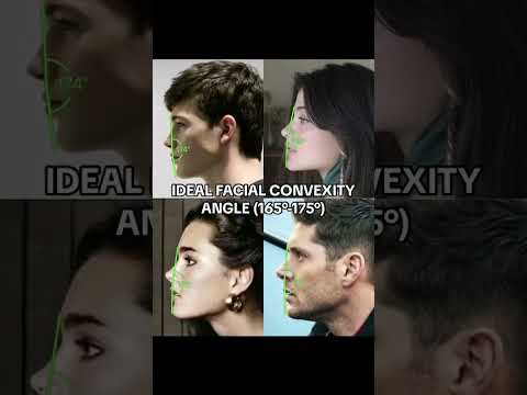 Facial convexity angle \\