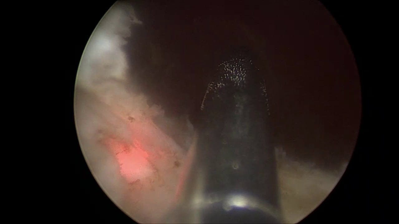 Pier Andrea Della Camera-95