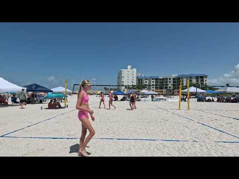 Upham Beach 6/8/25--vs Fisher/Mohan 21-7 Part 1