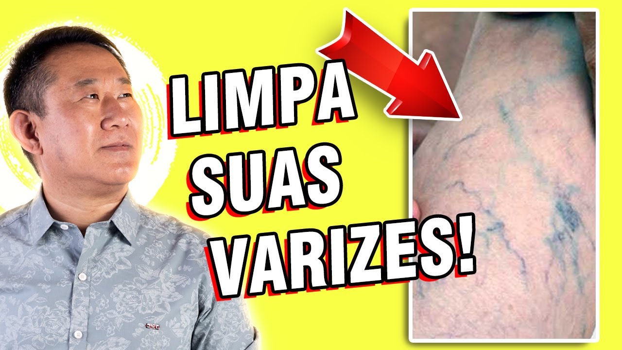 CONHEÇA ESSE CHÁ PODE AJUDAR SUAS VARIZES | Peter Liu