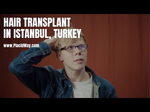 Hair Transplant in Istanbul, Turkey