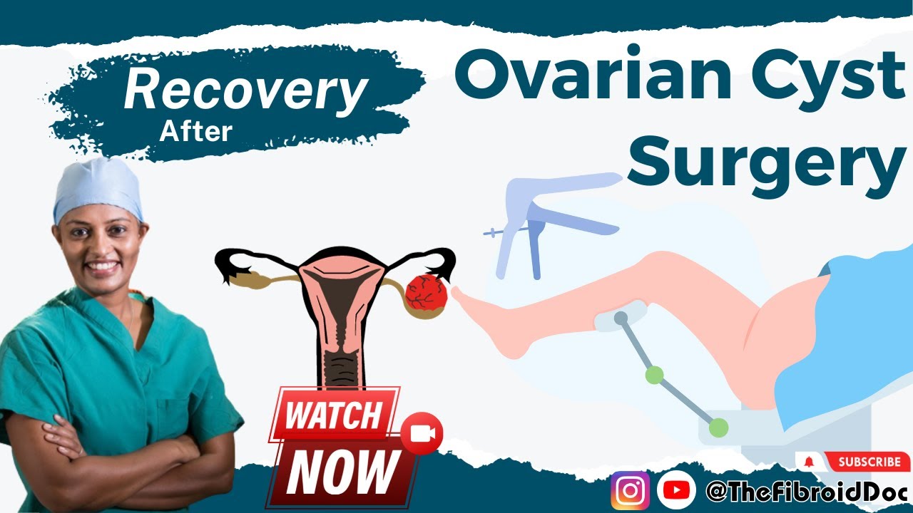 What does Recovery after an Ovarian Cyst Removal look like? Laparoscopic vs Open Surgery