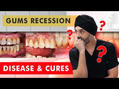 Gum Recession vs Gum Disease - and Treatments