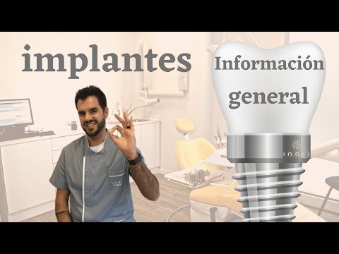 Informacion general sobre implantes