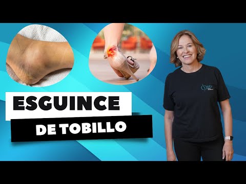 ESGUINCE DE CUELLO DE PIE