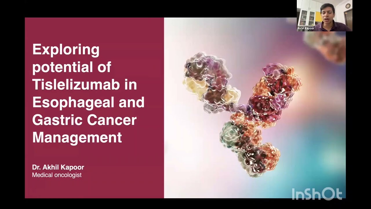 Tislelizumab in Esophageal and Gastric Cancer Management