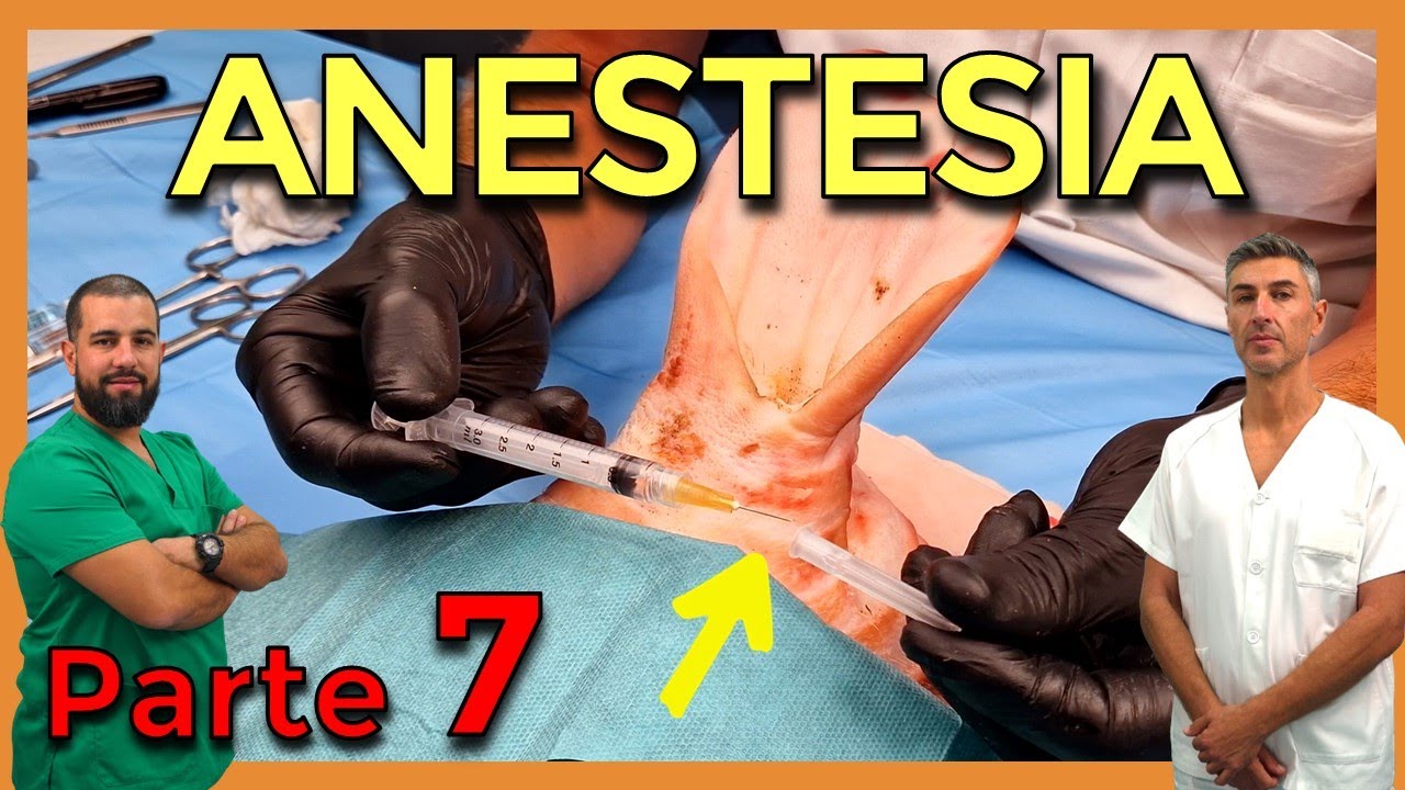 Cómo PONER ANESTESIA en CIRUGÍA MENOR – CIRUGÍA MENOR y SUTURAS (Parte 7)