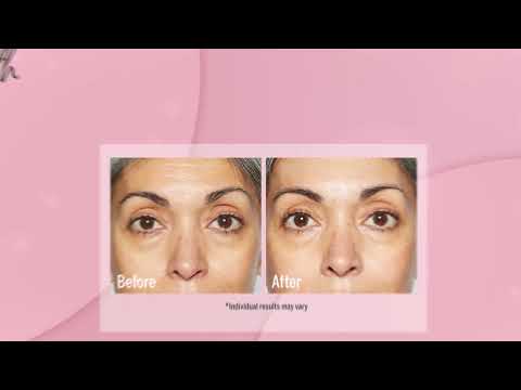 ✨ Polish, Brighten, and Glow with the SKINN Non-Negotiables DermAppeal Microdermabrasion Treatment!