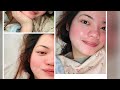 Face Swipe Challenge Bye Bye Acne