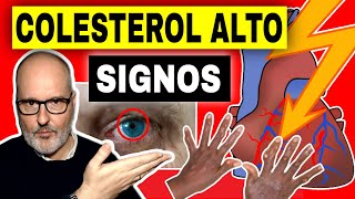 SIGNOS (Y SÍNTOMAS) DE COLESTEROL ALTO (CAUSAS y QUÉ HACER)