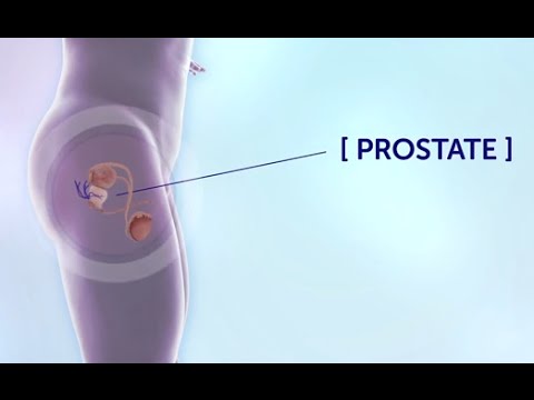 Prosztata fájdalom a péniszben