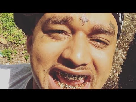 Chxpo - The Race (Freestyle)