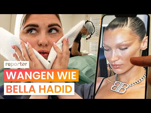 Buccal Fat Removal: Slim Cheeks at Any Cost? | reporter