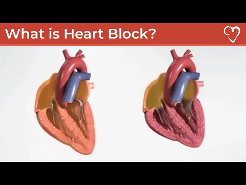 What is Heart Block?
