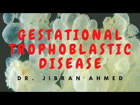 OSTEOGENIC TX II FLETCHERS 5TH E II ROBBINS 10TH E II POST GRADUATE LEARNING II DrJIBRANAHMED