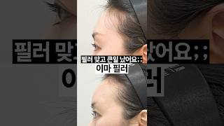 필러로 윤곽 정리했습니다 💫