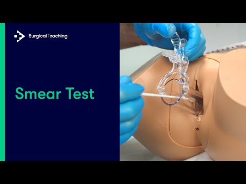 How to Perform a Pap Smear