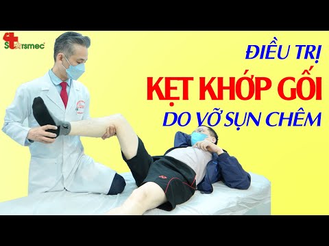 Kẹt khớp gối do vỡ sụn chêm - Điều trị thế nào?