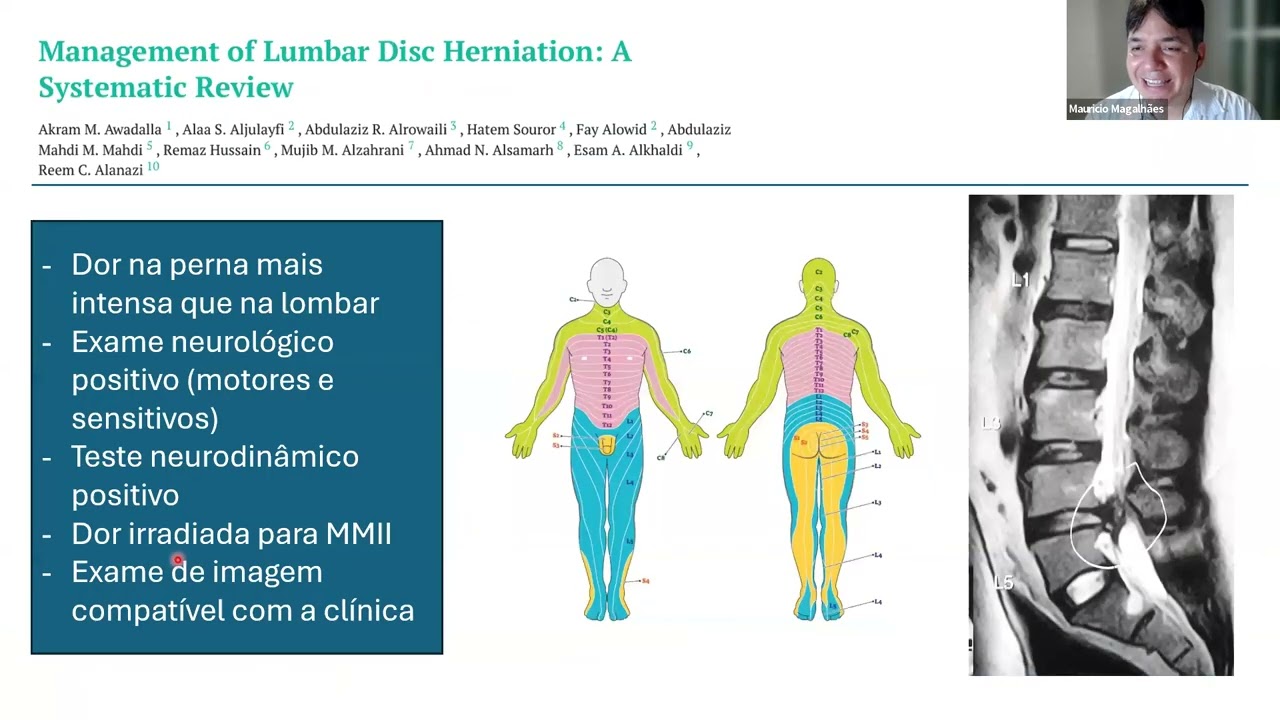 O que sabemos sobre o tratamento da dor lombar baseado em evidências Atualidades, Raciocínio Clínico