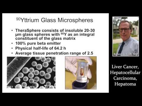 LIVER CANCER, HEPATOCELLULAR CARCINOMA, AND HEPATOMA by Dr. Robert Gish