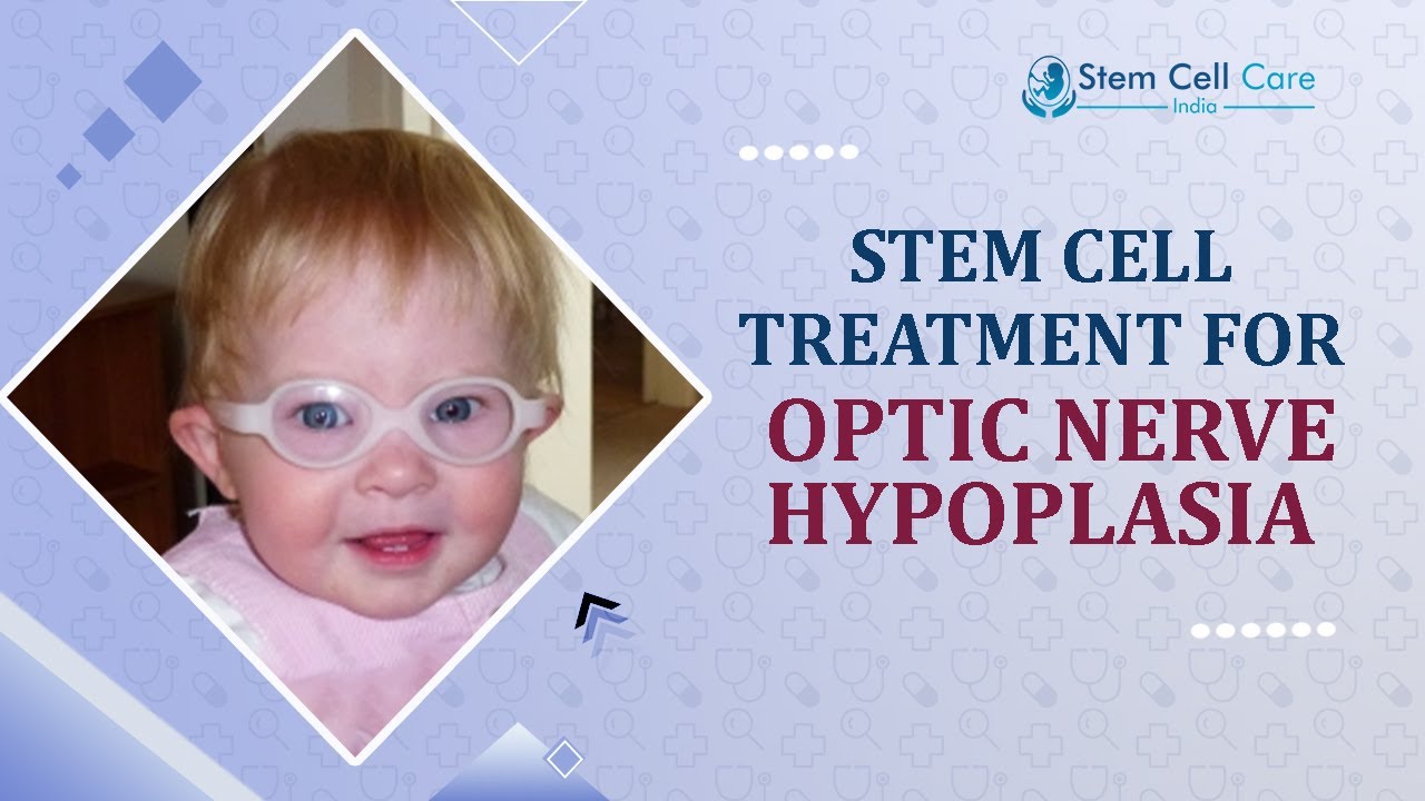 Best Stem Cell Treatment For Optic Nerve Hypoplasia | Optic Nerve Hypoplasia | Safe And Effective