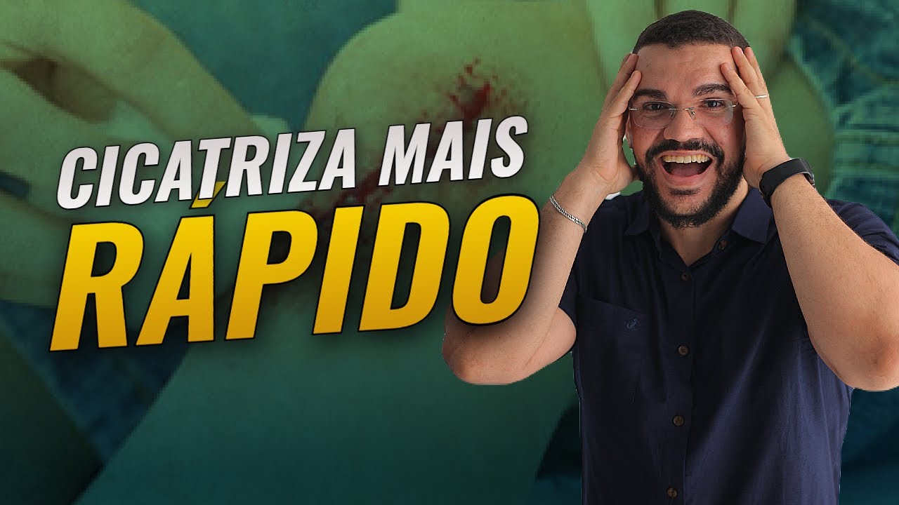 ALIMENTOS QUE AJUDAM A CICATRIZAR MAIS RÁPIDO QUALQUER FERIDA