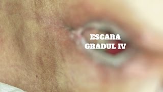 Afla ce solutie ai pentru o astfel de rana!