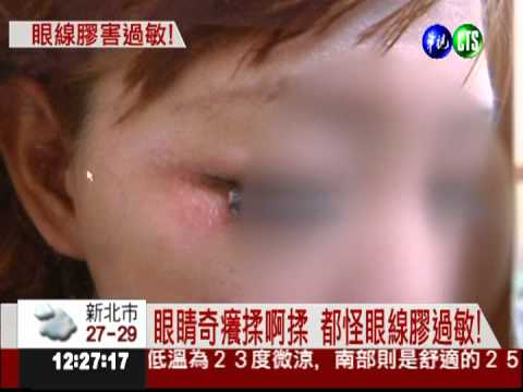 眼線膠致過敏 眼皮紅腫奇癢無比