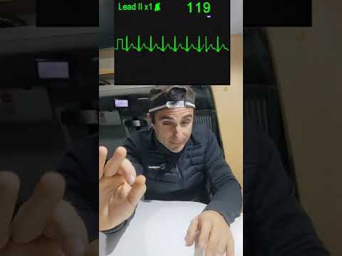 Why does your HEART RACE? #shorts #firstaid #didyouknow