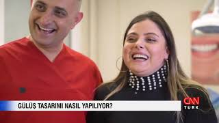 Estetik Gülüş Tasarımı Nedir? - Mock-up İşlemi | Estetik Diş Hekimi Ab