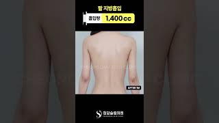 팔이 얇아지니까 어깨가 더 예뻐보임✨