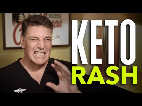 Ep:23 Keto Rash