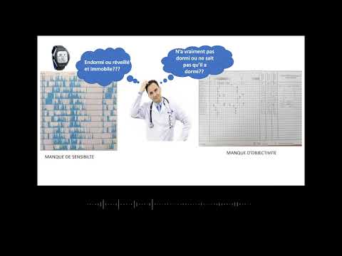 SATTE Amal:  A’Name, montre connectée pour le diagnostic et la prise en charge de l’insomnie