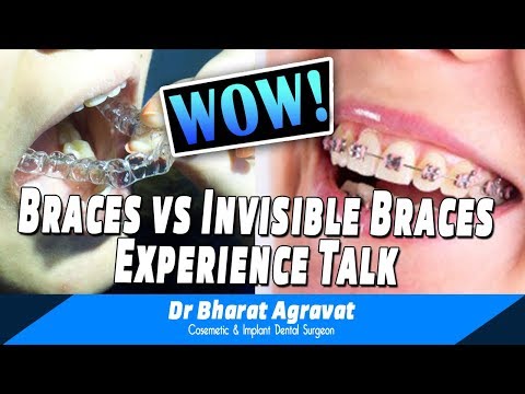 Invisible Clear Braces By Smile In Hour Dentist Dental Clinic India