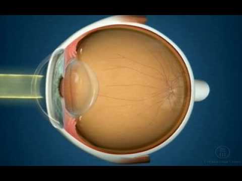 Anatomia do olho - Cristalino